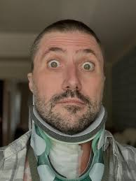 Here I am, a bald boy in a neck brace. My surgery went well and my recovery  has begun. The pain for the first few days was brutal. I was also having