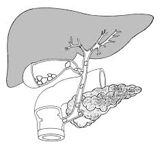 Dr daniel j bell ◉ and dr omar bashir et al. Biliary Tract With Stones In The Gallbladder And Common Bile Duct Media Asset Niddk