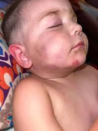 My only son has been missing since February 21st! 8days🥹 It only takes two  seconds to share! #somerset His name is: Ryan McAllen Age:15 Height: 5'3  Weight: 115 He was last seen