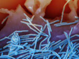 Check spelling or type a new query. As Covid Dissipates In U S Colds And Flu May Return With A Vengeance