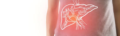 Steatoza hepatica este frecvent intalnita.de obicie nu da simptome, fapt care face ca boala sa fie depistata uneori in stadii avansate. Despre Steatoza HepaticÄƒ È™i Patologia InruditÄƒ Blog Sanador