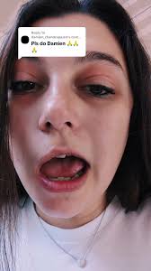 Bonbon Damian Girl Burger Damien Girl