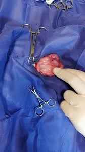 گالری جراحی های آدورینا | کلینیک آدورینا