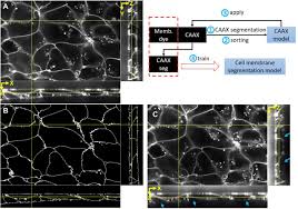 Maybe you would like to learn more about one of these? The Allen Cell And Structure Segmenter A New Open Source Toolkit For Segmenting 3d Intracellular Structures In Fluorescence Microscopy Images Biorxiv
