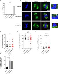 We will ensure we give you a high quality content that will give you a good grade. Initial Spindle Formation At The Oocyte Center Protects Against Incorrect Kinetochore Microtubule Attachment And Aneuploidy In Mice Biorxiv