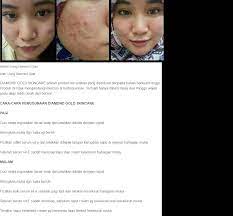 Sesuai untuk semua jenis kulit. Diamond Gold Skincare Set 5 In 1 Ready Stock Lazada