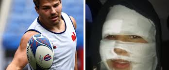 Antoine Dupont : "Il avait pris le crampon"... Les images impressionnantes  de la blessure au visage du capitaine des Bleus en jeunes - ladepeche.fr