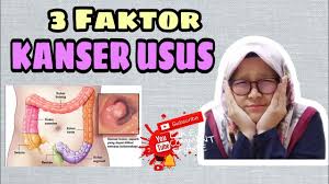 We did not find results for: Kanser Usus 3 Faktor Risiko Kanser Usus Youtube