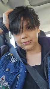 Introduction and living with epilepsy