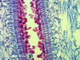 Check spelling or type a new query. Types Of Microscopes Microscope World Blog