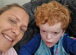 Gravesend youngster with rare genetic condition