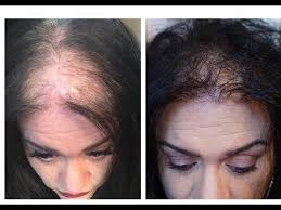 Oil treatments once or twice a week are a great way to promote hair growth and make hair thicker. Onion Coconut Oil For Extreme Hair Growth In 30 Days To Get Long Hair Thick Hair Naturally Yout Thick Hair Styles Thick Hair Remedies Thick Hair Solutions