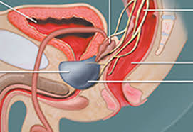 Learn more and watch the video overview. Is It The Prostate Or Prostrate Gland What Does It Do