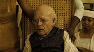 Check spelling or type a new query. Il Curioso Caso Di Benjamin Button La Malattia Che Ha Ispirato Il Look Di Brad Pitt Da Bambino Movieplayer It