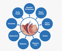 Image result for Obstructive Sleep Apnea