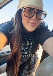 Chelsea Blackwell Forehead