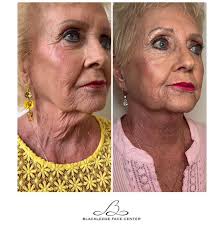 Blackledge Face Center