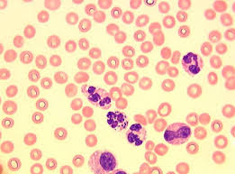 Image result for Intracellular Bacteria