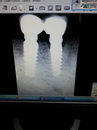 Shri Anandpur Trust Charitable Dental And Implant Centre Delhi Home Facebook