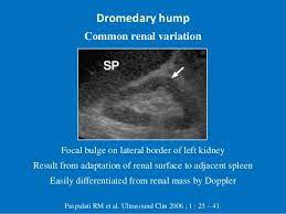 Although a lot of people think that the humps in camels and dromedaries are used to store water, this… is thanks to their humps, camels and dromedaries can stand up to two weeks without eating. Dromedary Hump Ultrasound Sonography Ultrasound Sonography