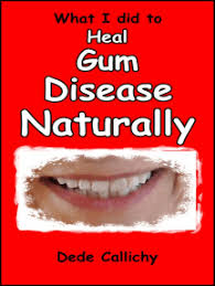 Read What I Did To Heal Gum Disease Naturally Online By Dede Callichy Books