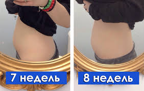 Normal Li Chto Zhivot Rastet Uzhe Na 8 Nedele
