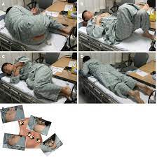 Consequently there is less zone 1 and more zones 2 and 3 blood flow in the lateral decubitus position compared with the upright position (alveolar pressure (p Auxiliary Techniques A Left Lateral Decubitus Position B Supine Download Scientific Diagram