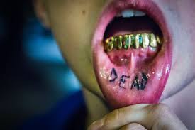 39 votes) when you drink soda, the sugars it contains interact with bacteria in your mouth to form acid. How Long Does It Take For A Nerve In A Tooth To Die Video