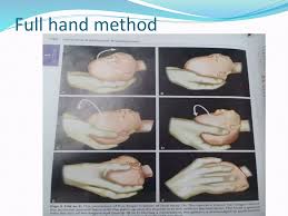 Image result for Manual Rotation in Occipitoposterior Presentation