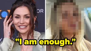 Courtney Stodden Dissolved Her Fillers Before And After