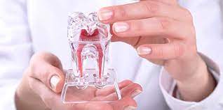 Druckschmerz Wenn S Beim Beissen Weh Tut Dentalwissen