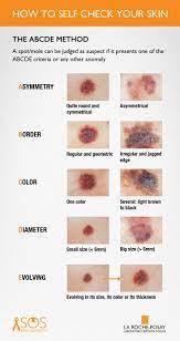 Another important sign is a spot that looks different from all of the other spots on your skin (known as the ugly duckling sign). Pin On Summer Sun Protection