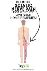 Pin On Sciatica
