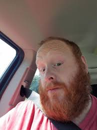 The Story of Rob Mallory