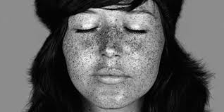 Cara Phillips Ultraviolet Photographs Show Sun Damage