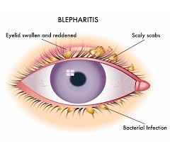 Image result for Blepharis affinis