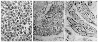 Image result for Buchnera