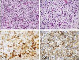 Image result for mastocytoma in dogs