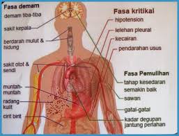 Demam denggi berdarah (dhf) juga dikenali sebagai demam denggi yang teruk. Demam Denggi Aida Vitamin