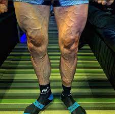 This content is imported from instagram. Movistar S Jose Joaquin Rojas Posts Picture Of His Legs Mid Giro D Italia And Photo Goes Viral Road Cc