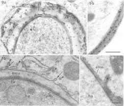 Plant cell labeled black and white. A B Immunogold Labelling Of Un Esterified Pectin Jim5 And Plant Download Scientific Diagram