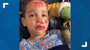 6-year-old hit by a car while trick-or-treating thanks everyone for the  love