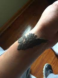 I started experiencing extreme itching to the sites about 4 days ago and it is not getting better. Is Raised And Itching Skin Normal After Tattoo Removal Photos