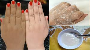 Amalan lain yang kami syorkan untuk anda ikuti tentang cara nak hilangkan jeragat dengan cepat disamping anda. Cara Memutihkan Kulit Tangan Dan Kaki Paling Cepat Secara Alami Youtube