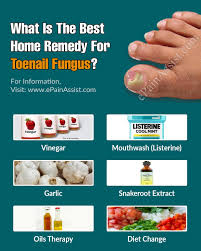 home remedy for toenail fungus