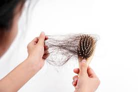 Hair Fall In Monsoon: Causes ...