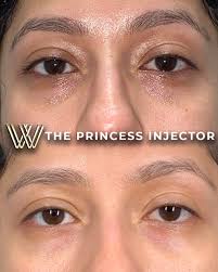 Sheree Jackson NP-C,MSN,BSN (@princessinjector.sheree) · Orlando, FL