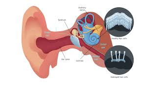 Check spelling or type a new query. Tinnitus Doctors Australia