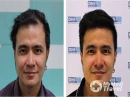 Ask any dermatology question in 1:1 online chat right now. 10 Best Clinics For Dermatology In Philippines 2021 Prices