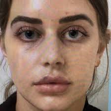 THOMAS W LOEB, MD PC